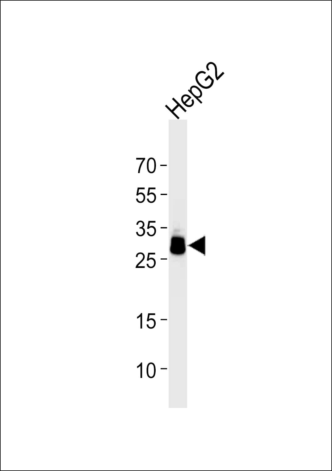 PPT1 / CLN1 Antibody (aa1-306, clone 1117CT11.2.1.4)