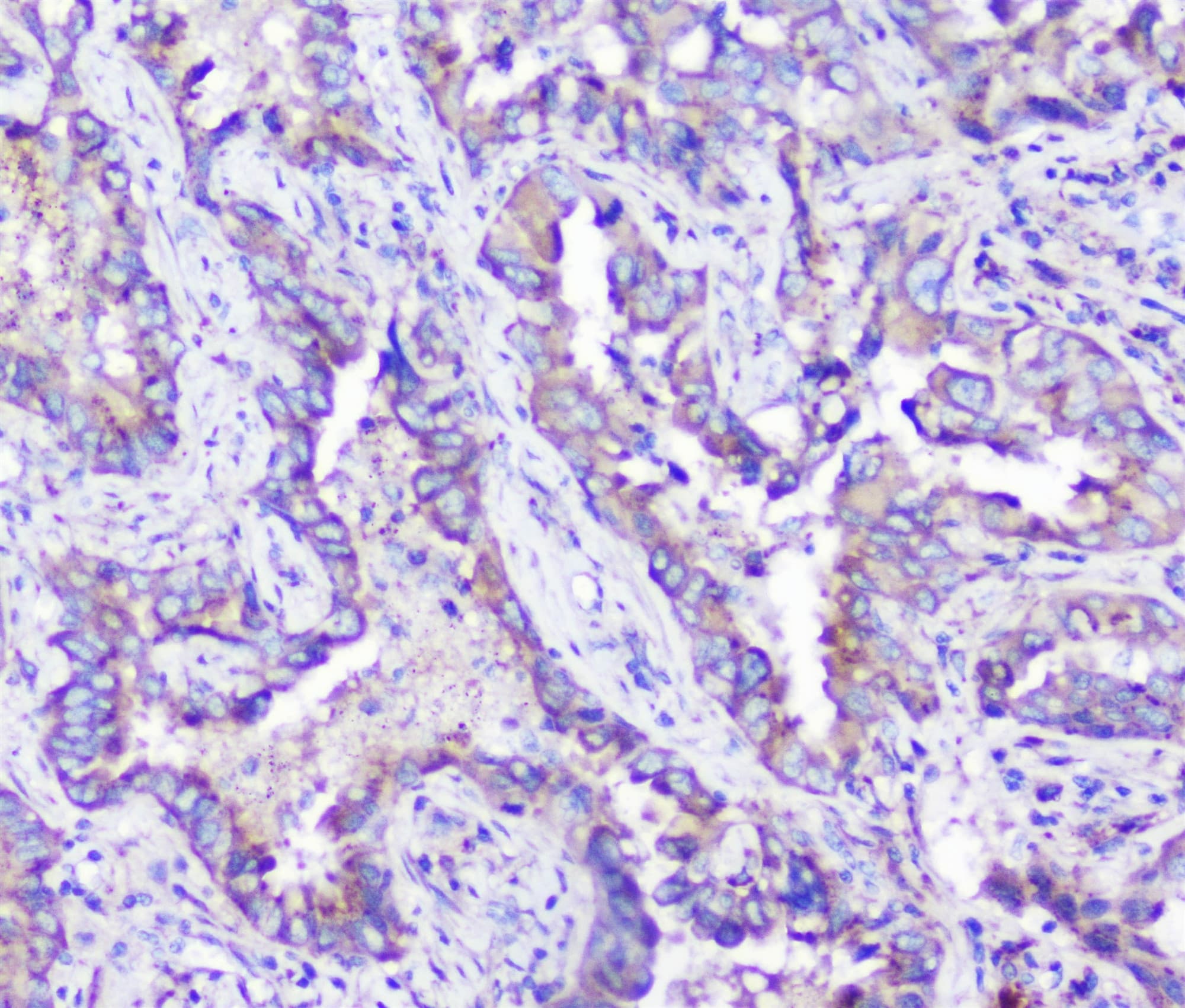 ARSA / Arylsulfatase A Antibody