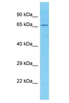 SH3D21 / C1orf113 Antibody (aa539-588)