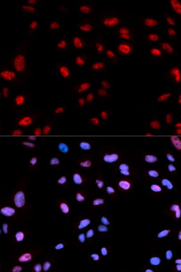HIST1H3B Antibody (phospho-Thr12)