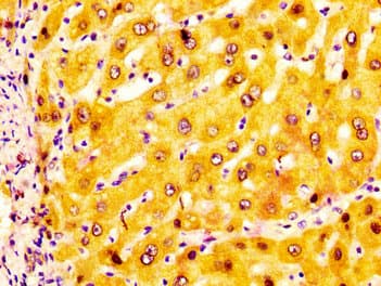 Polyclonal Rabbit anti-Human ADH1A / Alcohol Dehydrogenase Antibody (IHC)
