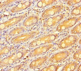 RSPO3 Antibody