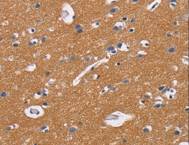 Polyclonal Rabbit anti-Human CD47 Antibody (IHC)