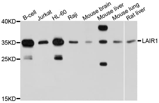 LAIR1 / CD305 Antibody
