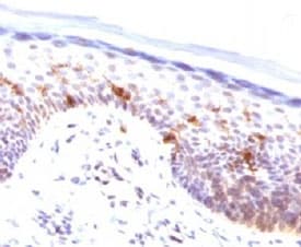 CD1A Antibody (clone CLDA1a)