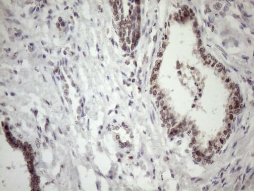 Monoclonal Mouse anti-Human MED15 / ARC105 Antibody (clone OTI3F1, Carrier-free, aa393-679, IHC)