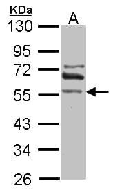 RALDH2 / ALDH1A2 Antibody (aa278-518)