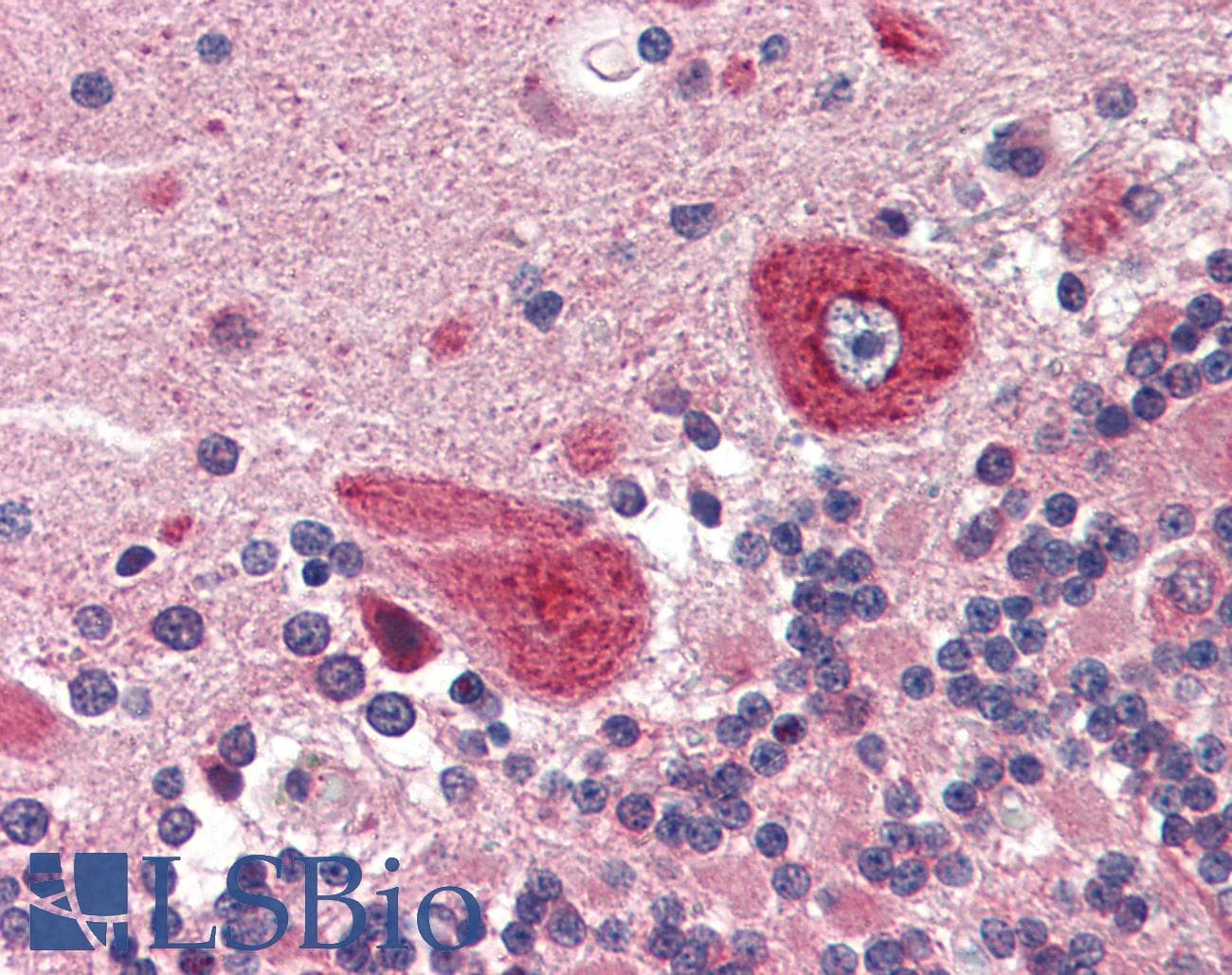 IHC-plus™ Polyclonal Rabbit anti-Human GUCY1B3 Antibody (aa189-207, IHC)