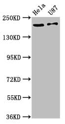 Polyclonal Rabbit anti-Human SCN10A / Nav1.8 Antibody (IF, WB)