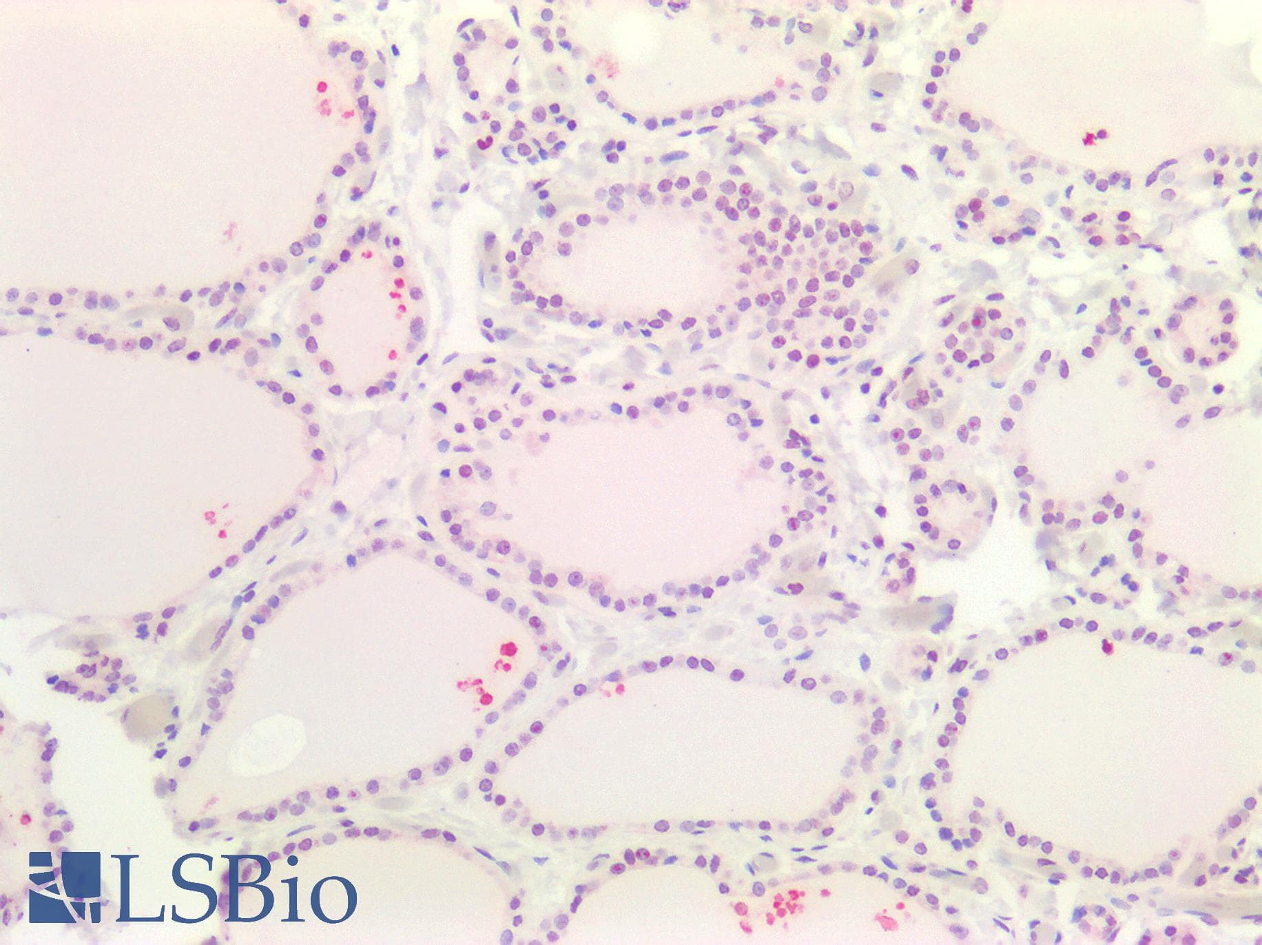 IHC-plus™ TTF1 / Txn Termination Factor Antibody