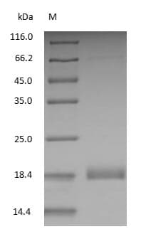 LGB / Beta-Lactoglobulin Protein (Native)