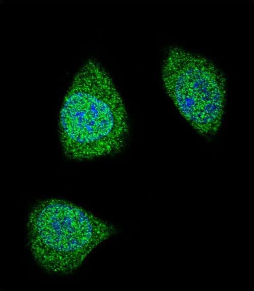 Polyclonal Rabbit anti-Human PDGF-BB Antibody (aa212-241, IF, WB)