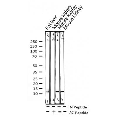 Polyclonal Rabbit anti-Human Histone H4 Antibody (Acetyl-Lys5, IHC, IF, WB)