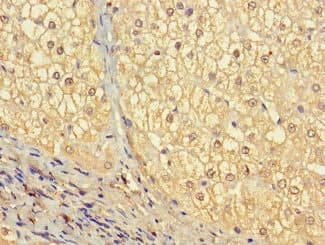 Polyclonal Rabbit anti-Human VTN / Vitronectin Antibody (IHC, IF, WB)