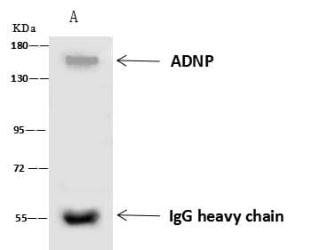 Polyclonal Rabbit anti-Human ADNP Antibody (IF, WB)