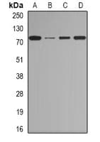 Polyclonal Rabbit anti-Human CTCFL / BORIS Antibody (IF, WB)