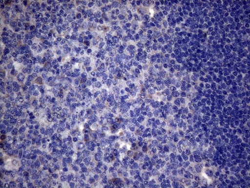AKIP1 / BCA3 Antibody (clone OTI2E4)