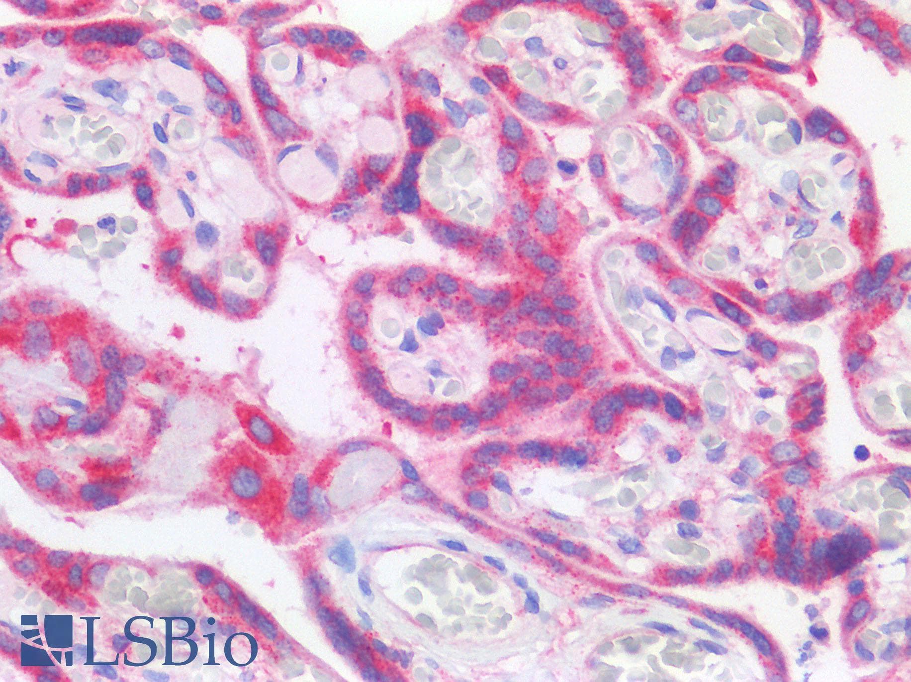 IHC-plus™ Monoclonal Mouse anti-Human TIMP3 Antibody (aa170-188, IHC, WB)