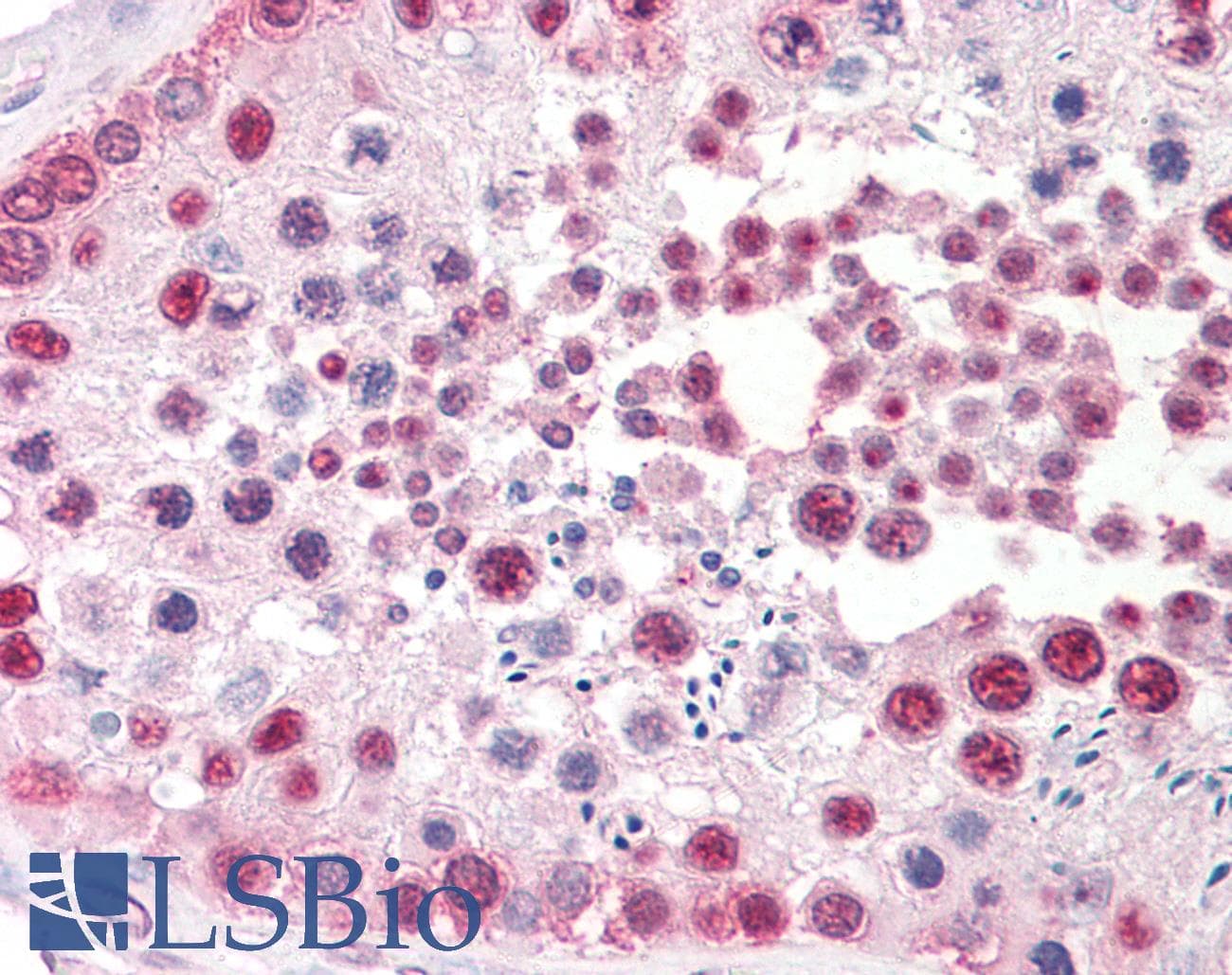 IHC-plus™ Polyclonal Rabbit anti-Human TSPY1 / TSPY Antibody (IHC, WB)