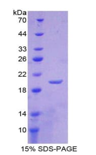 Human LCN1 / Lipocalin-1 Protein (Recombinant His-T7)