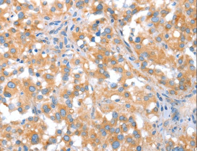 ST14 / Matriptase Antibody