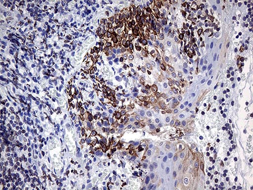 MLH1 Antibody (aa299-527, clone OTI3D1, Carrier-free)