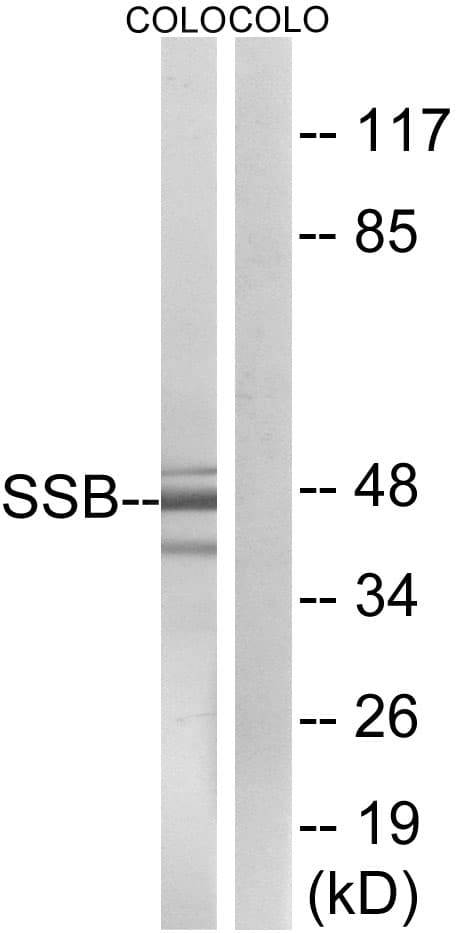 IHC-plus™ SSB / La Antibody (aa341-390)