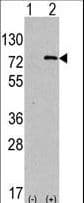 Apg7 / ATG7 Antibody (aa494-523)