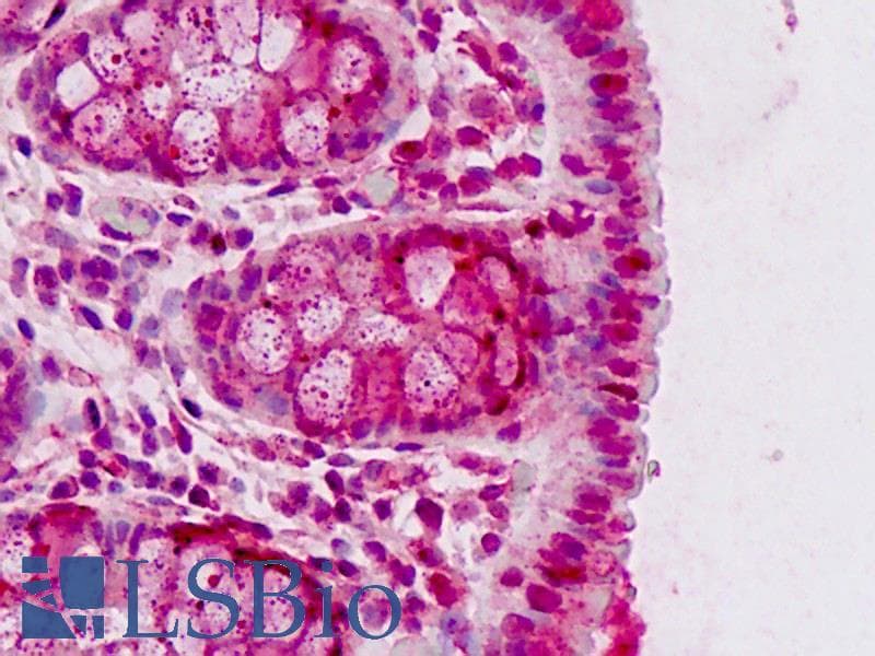 IHC-plus™ ARID3B Antibody (aa409-439)