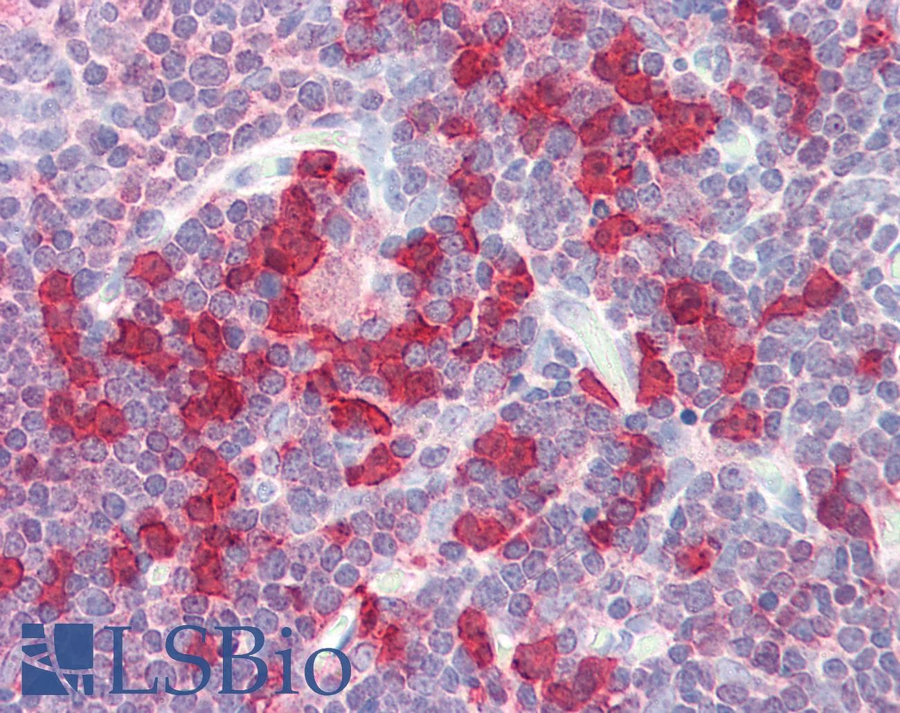 IHC-plus™ TNFSF13 / APRIL Antibody