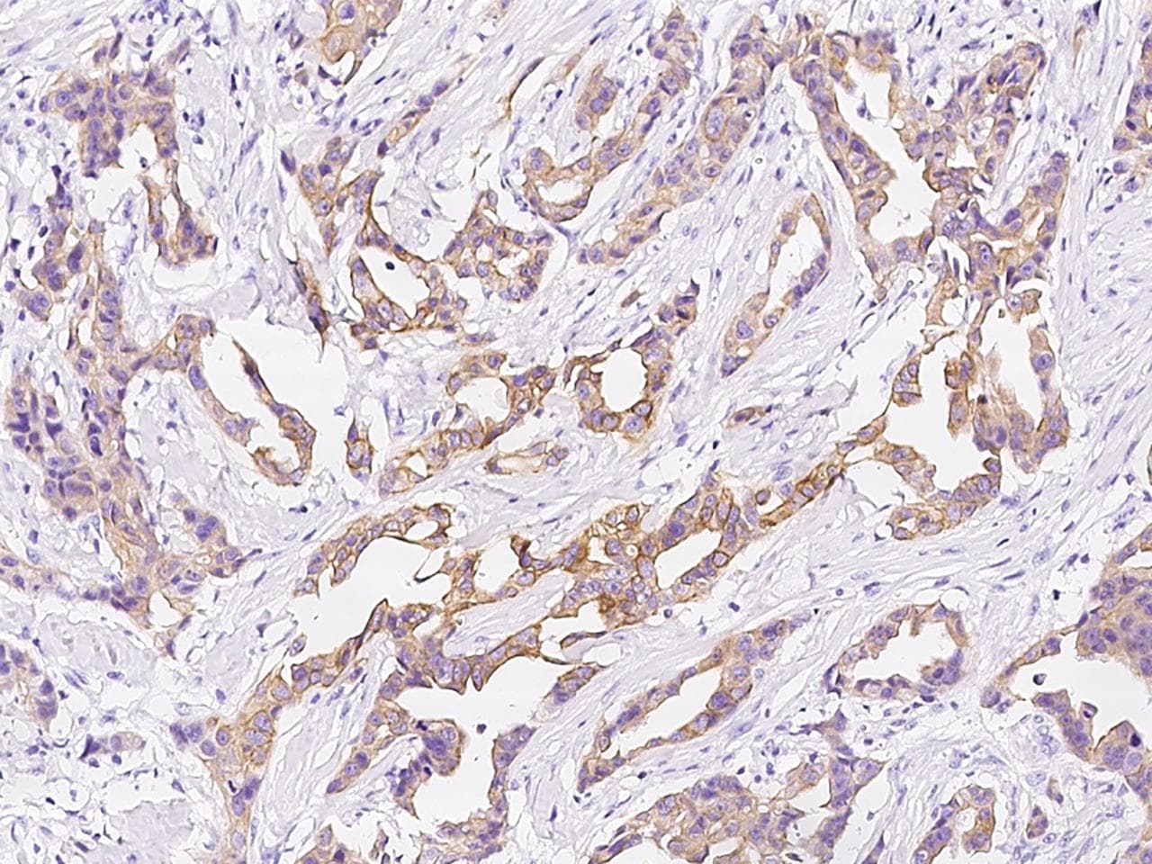 KRT10 / CK10 / Cytokeratin 10 Antibody