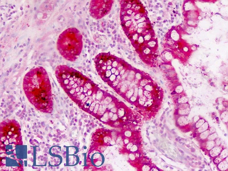 IHC-plus™ AGR2 Antibody (aa95-124)