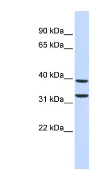 Polyclonal Rabbit anti-Human ZNF177 / PIGX Antibody (C-Terminus, WB)