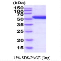 Human DDC / DOPA Decarboxylase Protein (Recombinant His)