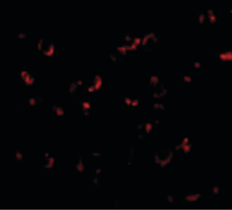 BICD1 Antibody