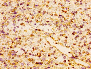 Polyclonal Rabbit anti-Human CCL17 / TARC Antibody (IHC)