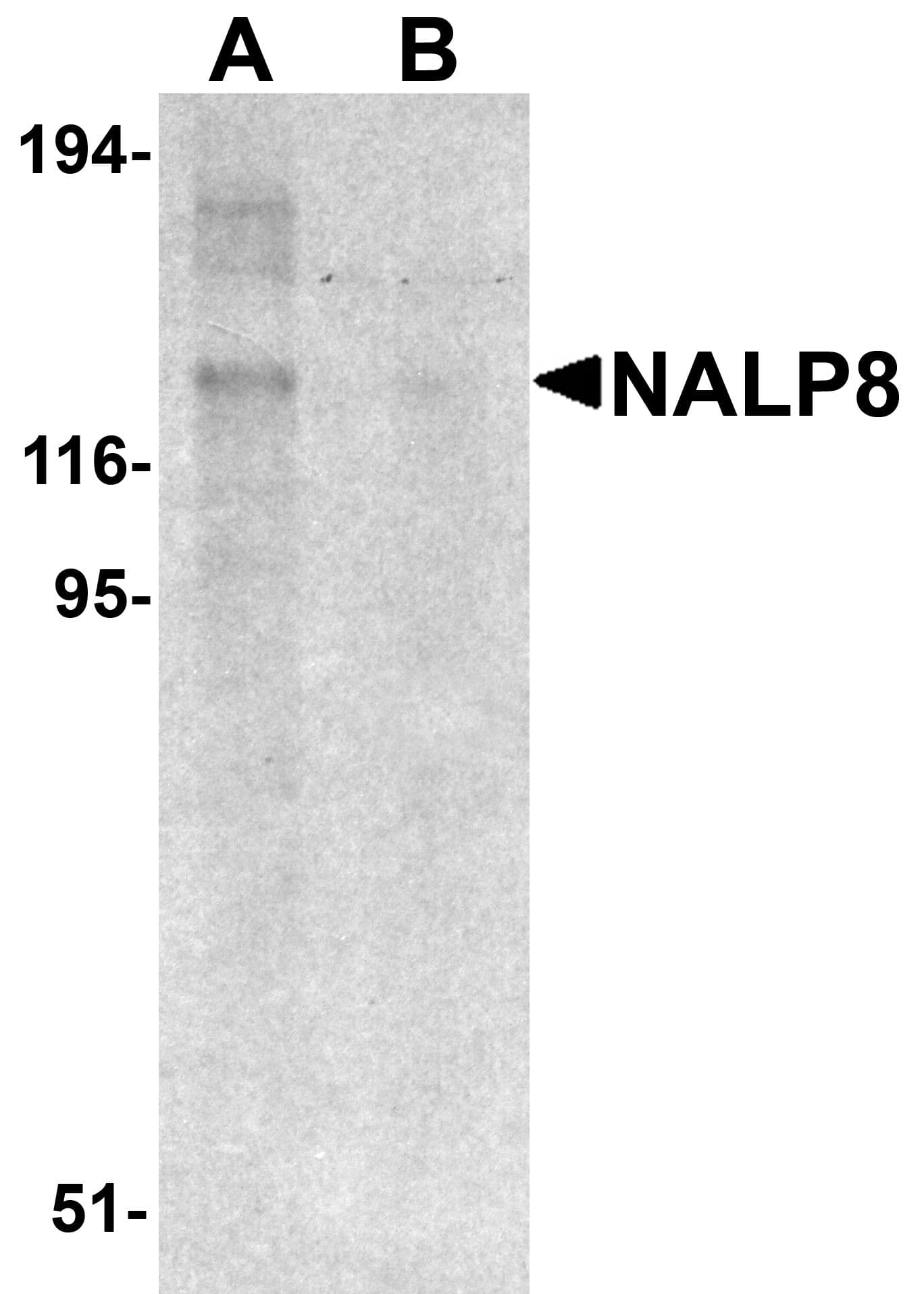 IHC-plus™ Polyclonal Rabbit anti-Human NLRP8 Antibody (IHC, WB)