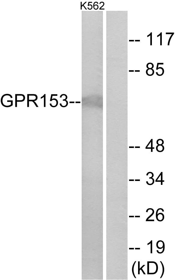 Polyclonal Rabbit anti-Human PGR1 / GPR153 Antibody (aa195-244, IF, WB)