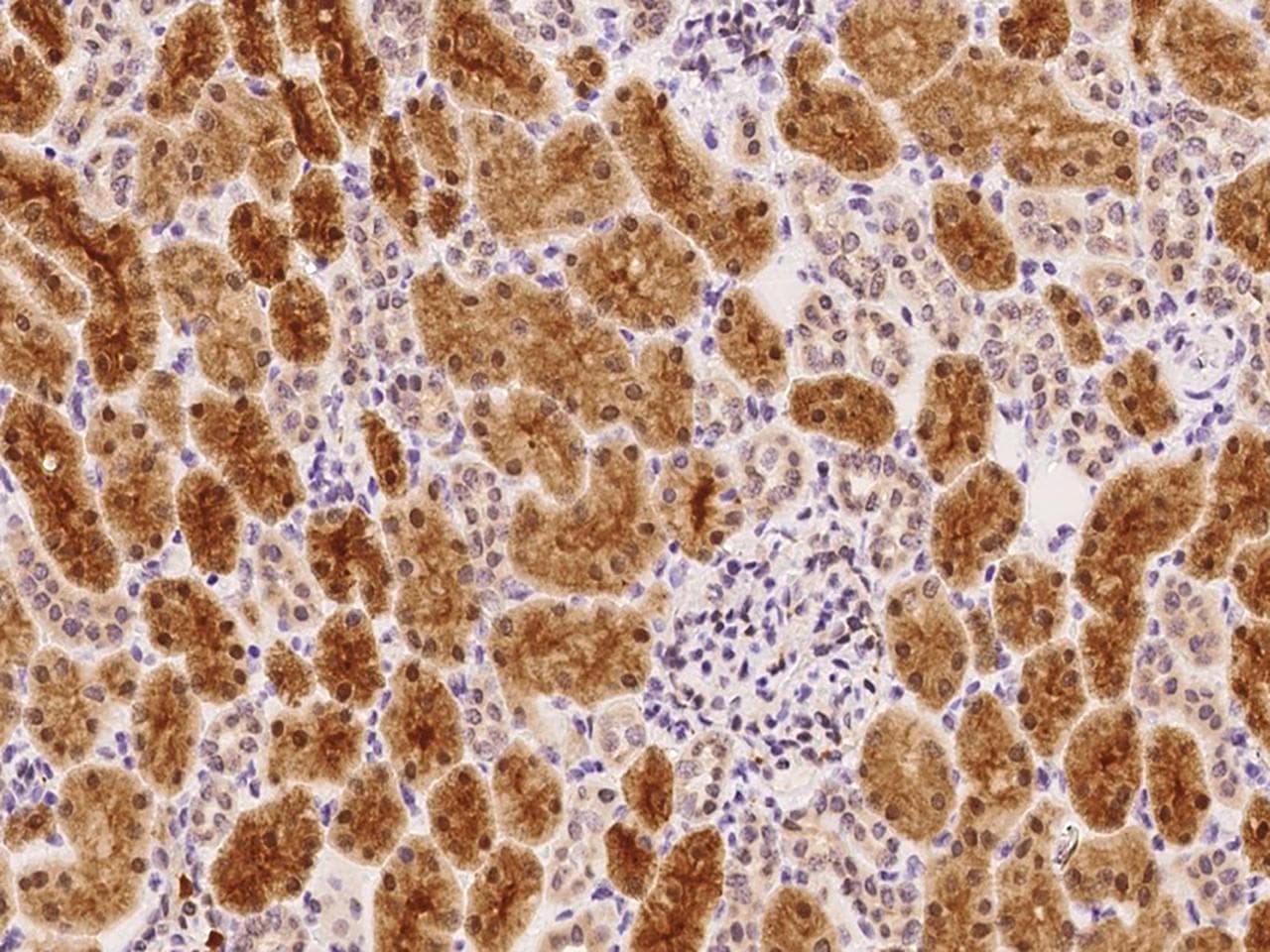 HIF1AN Antibody (Preservative Free)