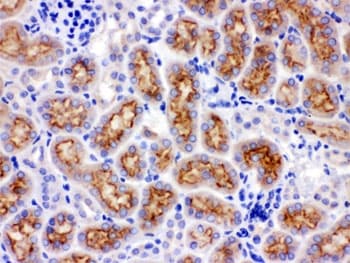 Polyclonal Rabbit anti-Human CYP24 / CYP24A1 Antibody (aa153-514, IHC, WB)