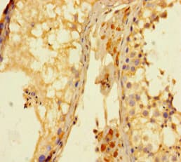 KDM4A / JHDM3A / JMJD2A Antibody