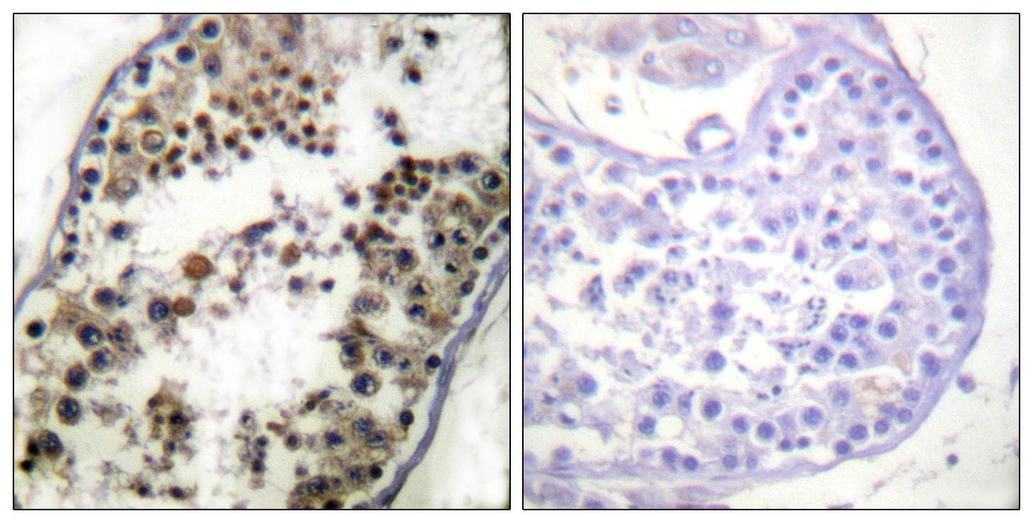 Polyclonal Rabbit anti-Human JUN / c-Jun Antibody (p231, IHC, IF, WB)