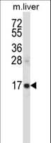 Polyclonal Rabbit anti-Human SSSCA1 / p27 Antibody (aa9-37, WB)
