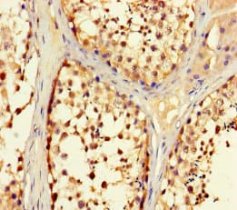 Polyclonal Rabbit anti-Human TRIM36 Antibody