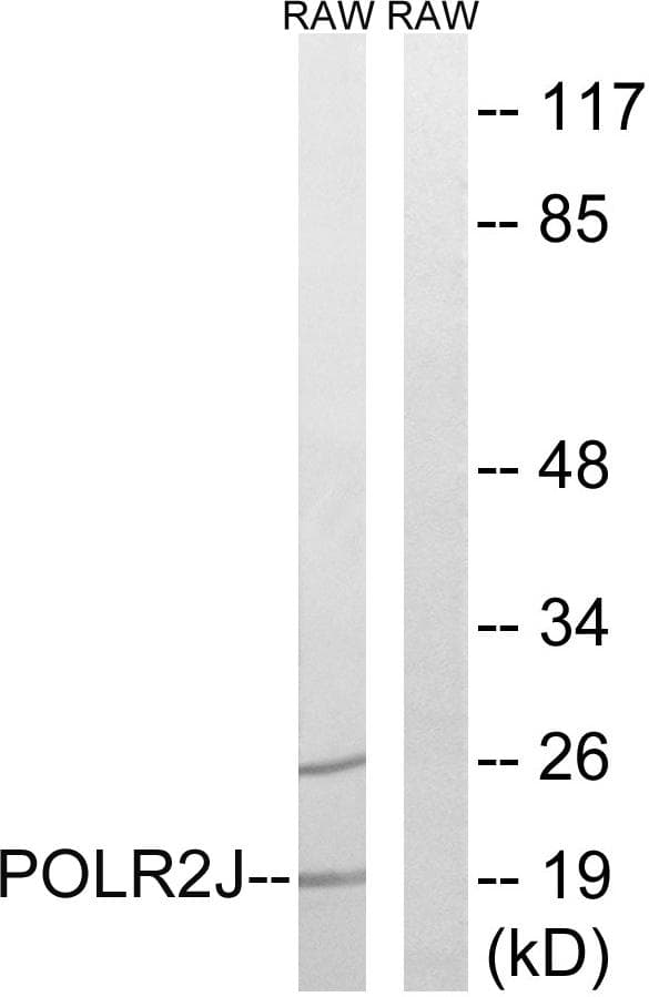 Polyclonal Rabbit anti-Human POLR2J Antibody (WB)
