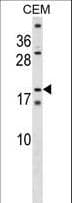 Polyclonal Rabbit anti-Human SSX4 Antibody (aa69-97, WB)