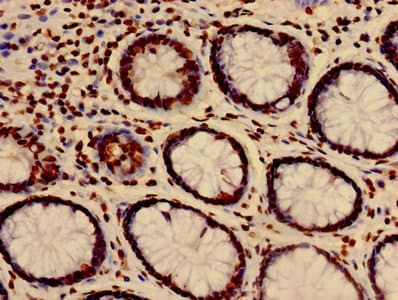 HIST1H3A Antibody