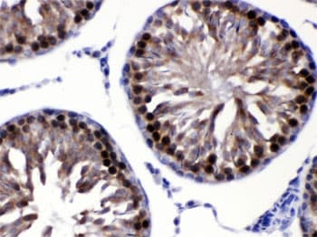 Polyclonal Rabbit anti-Human CACYBP Antibody (IHC, WB)