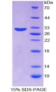 Human SERPINB1 Protein (Recombinant His-T7)