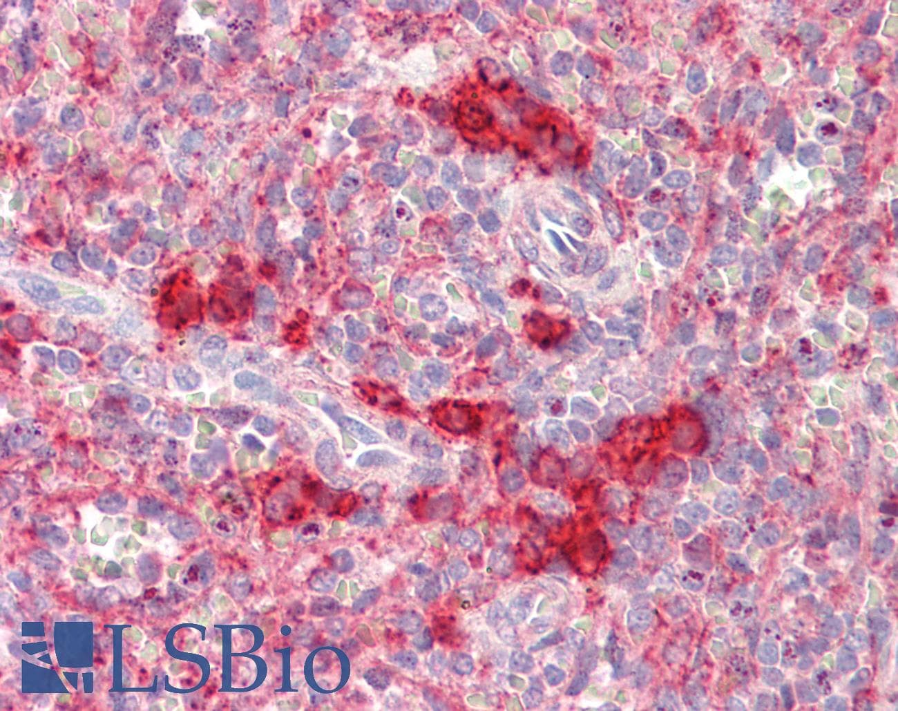 IHC-plus™ TSHZ2 Antibody